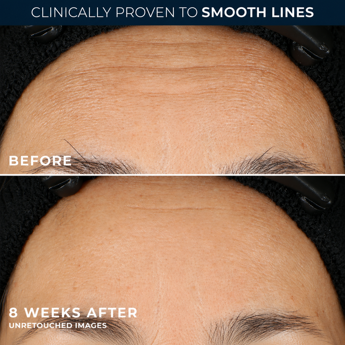 Retinol Night Serum Capsules – Smoothing Anti-Aging Skincare